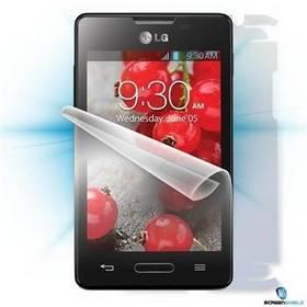 Ochranná fólie Screenshield na celé tělo pro LG E440 Optimus L4 II (LG-E440-B)