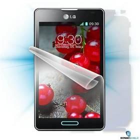 Ochranná fólie Screenshield na celé tělo pro LG P710 Optimus L7 II (LG-P710-B)